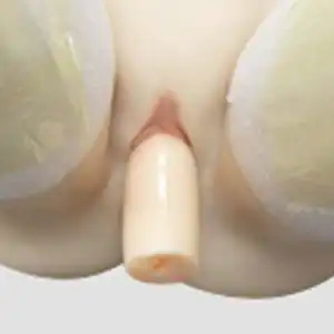Removable